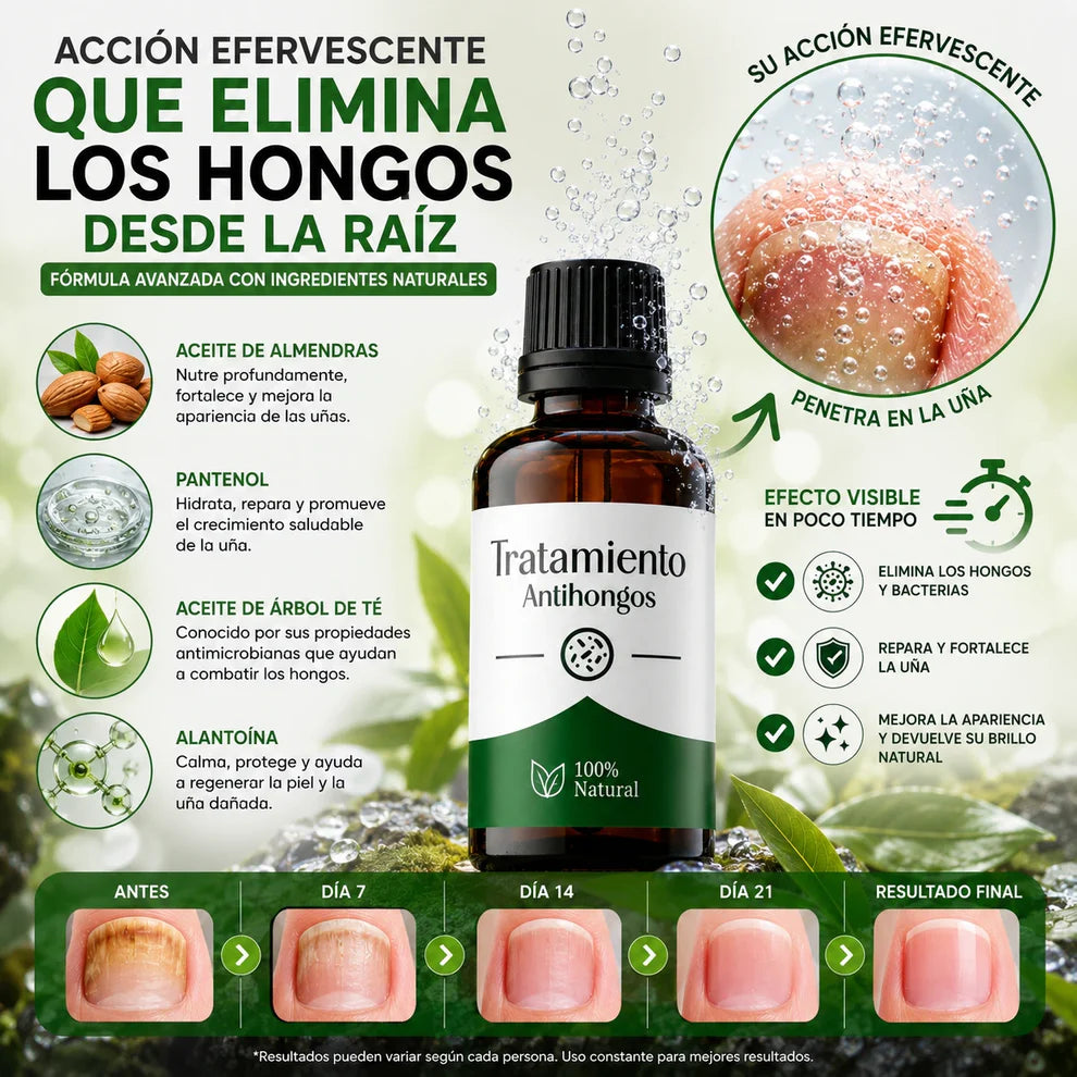 FungiStop® – Tratamiento de 60 días para los hongos PAGA 1 LLEVA 2