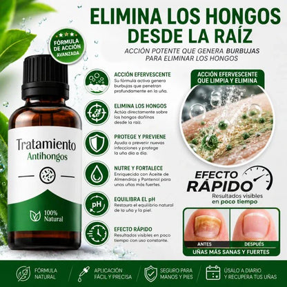 FungiStop® – Tratamiento de 60 días para los hongos   PAGA 1 LLEVA 2