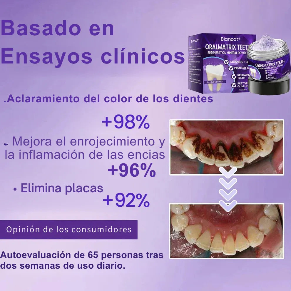 OralMatrix BiancatⓇ