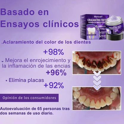 OralMatrix BiancatⓇ