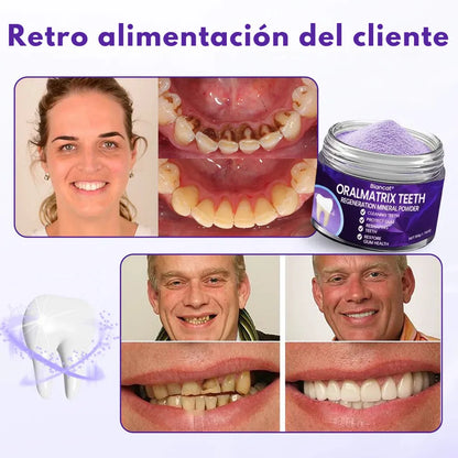 OralMatrix BiancatⓇ