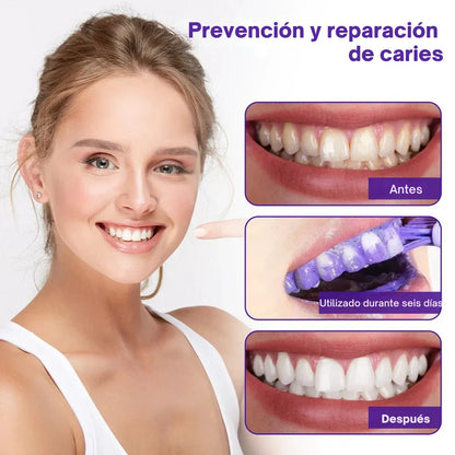 OralMatrix BiancatⓇ