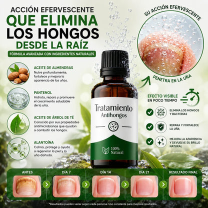 FungiStop® – Tratamiento de 60 días para los hongos   PAGA 1 LLEVA 2
