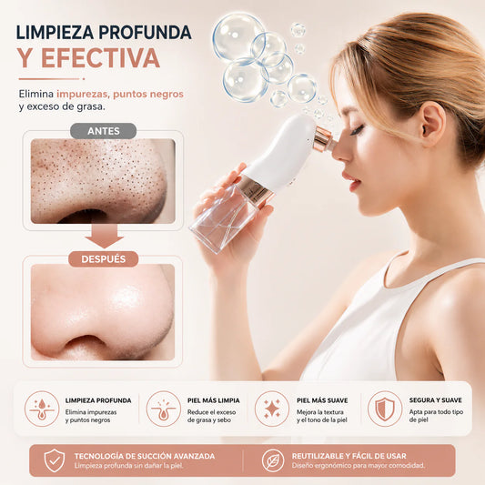 Extractor de puntos negros